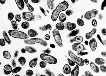 Imagen: El patógeno Coxiella burnetii (Fotografía cortesía de Laboratorios Rocky Mountain).